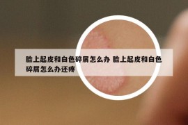 臉上起皮和白色碎屑怎么辦 臉上起皮和白色碎屑怎么辦還疼