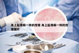 身上起像癬一樣的疙瘩 身上起像癬一樣的疙瘩圖片