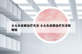 小兒頭皮癬治療方法 小兒頭皮癬治療方法有哪些