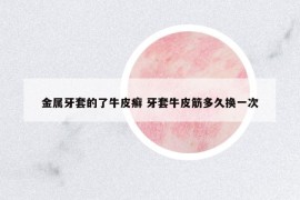 金屬牙套的了牛皮癬 牙套牛皮筋多久換一次