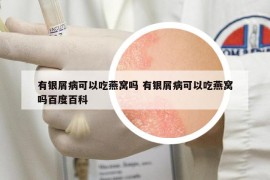 有銀屑病可以吃燕窩嗎 有銀屑病可以吃燕窩嗎百度百科