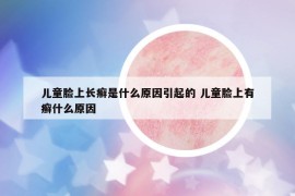 兒童臉上長癬是什么原因引起的 兒童臉上有癬什么原因