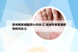 鄭州銀屑病醫(yī)院to劉長江 鄭州市銀屑病研究所劉長江