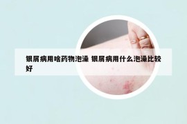 銀屑病用啥藥物泡澡 銀屑病用什么泡澡比較好