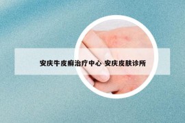 安慶牛皮癬治療中心 安慶皮膚診所