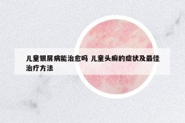 兒童銀屑病能治愈嗎 兒童頭癬的癥狀及最佳治療方法