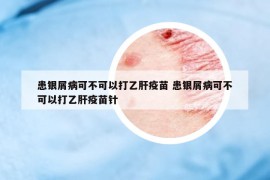 患銀屑病可不可以打乙肝疫苗 患銀屑病可不可以打乙肝疫苗針