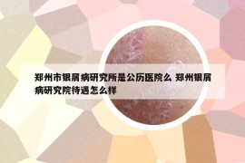 鄭州市銀屑病研究所是公歷醫(yī)院么 鄭州銀屑病研究院待遇怎么樣