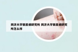 同濟大學(xué)銀屑病研究所 同濟大學(xué)銀屑病研究所怎么樣