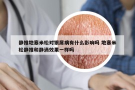 靜推地塞米松對(duì)銀屑病有什么影響嗎 地塞米松靜推和靜滴效果一樣嗎