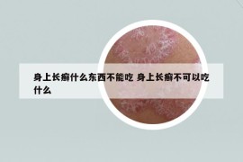 身上長癬什么東西不能吃 身上長癬不可以吃什么