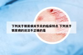 下列關(guān)于銀屑病關(guān)節(jié)炎的臨床特點(diǎn) 下列關(guān)于銀屑病的說(shuō)法不正確的是