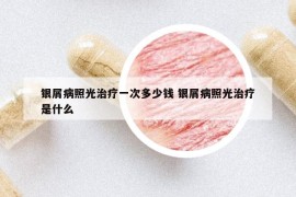 銀屑病照光治療一次多少錢 銀屑病照光治療是什么