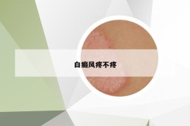 白癜風(fēng)疼不疼