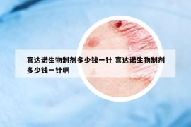 喜達諾生物制劑多少錢一針 喜達諾生物制劑多少錢一針啊