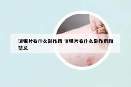 消銀片有什么副作用 消銀片有什么副作用和禁忌