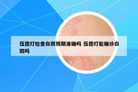 伍德燈檢查白斑初期準(zhǔn)確嗎 伍德燈能確診白斑嗎