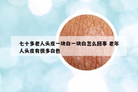 七十多老人頭皮一塊白一塊白怎么回事 老年人頭皮有很多白色