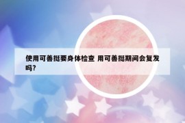 使用可善挺要身體檢查 用可善挺期間會(huì)復(fù)發(fā)嗎?