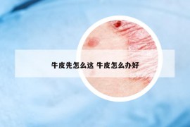 牛皮先怎么這 牛皮怎么辦好