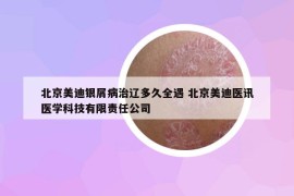 北京美迪銀屑病治遼多久全遇 北京美迪醫(yī)訊醫(yī)學科技有限責任公司