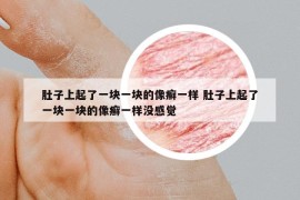 肚子上起了一塊一塊的像癬一樣 肚子上起了一塊一塊的像癬一樣沒感覺