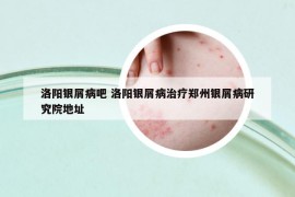 洛陽銀屑病吧 洛陽銀屑病治療鄭州銀屑病研究院地址