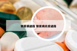 銀屑病通路 銀屑病炎癥通路