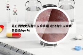 男方因?yàn)榕接信Ｆぐ_離婚 老公有牛皮廨我會(huì)感染hpv嗎