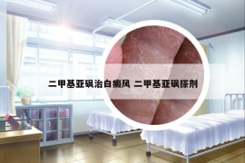 二甲基亞砜治白癜風(fēng) 二甲基亞砜搽劑