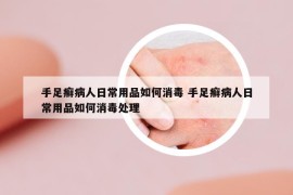 手足癬病人日常用品如何消毒 手足癬病人日常用品如何消毒處理
