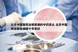 北京中醫(yī)醫(yī)院治銀屑病的中藥貴么 北京中醫(yī)院治銀屑病哪個(gè)專家好