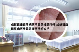成都銀康銀屑病醫(yī)院是正規(guī)醫(yī)院嗎 成都銀康銀屑病醫(yī)院是正規(guī)醫(yī)院嗎知乎