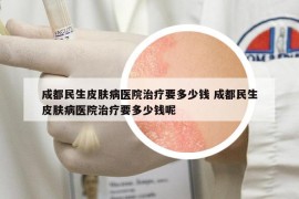 成都民生皮膚病醫(yī)院治療要多少錢(qián) 成都民生皮膚病醫(yī)院治療要多少錢(qián)呢