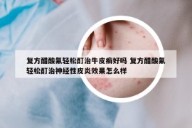 復(fù)方醋酸氟輕松酊治牛皮癬好嗎 復(fù)方醋酸氟輕松酊治神經(jīng)性皮炎效果怎么樣