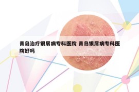 青島治療銀屑病專(zhuān)科醫(yī)院 青島銀屑病專(zhuān)科醫(yī)院好嗎