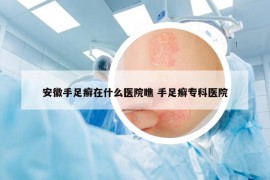 安徽手足癬在什么醫(yī)院瞧 手足癬?？漆t(yī)院