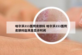 哈爾濱211醫(yī)院皮膚科 哈爾濱211醫(yī)院皮膚科趙鳳蓮出診時間