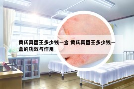 黃氏真菌王多少錢一盒 黃氏真菌王多少錢一盒的功效與作用