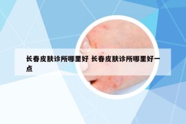 長春皮膚診所哪里好 長春皮膚診所哪里好一點