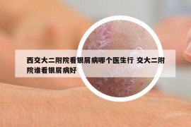 西交大二附院看銀屑病哪個(gè)醫(yī)生行 交大二附院誰(shuí)看銀屑病好
