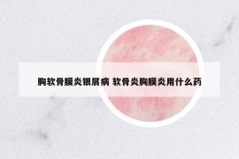 胸軟骨膜炎銀屑病 軟骨炎胸膜炎用什么藥