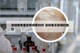 洛陽(yáng)哪里看皮膚病看的好 洛陽(yáng)看皮膚病的醫(yī)院
