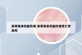 依奇珠單抗副作用 依奇珠單抗副作用死亡率高嗎