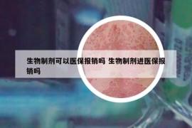 生物制劑可以醫(yī)保報銷嗎 生物制劑進(jìn)醫(yī)保報銷嗎