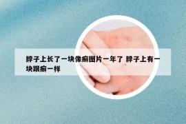 脖子上長(zhǎng)了一塊像癬圖片一年了 脖子上有一塊跟癬一樣