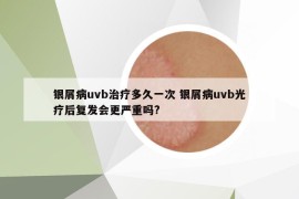 銀屑病uvb治療多久一次 銀屑病uvb光療后復發(fā)會更嚴重嗎?