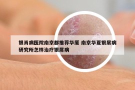 銀肖病醫(yī)院南京都推薦華廈 南京華夏銀屑病研究所怎樣治療銀屑病