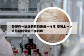 胳膊有一塊皮膚粗糙像癬一樣癢 胳膊上一小塊很粗糙像癬一樣很癢