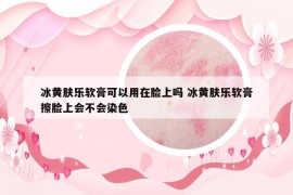 冰黃膚樂軟膏可以用在臉上嗎 冰黃膚樂軟膏擦臉上會不會染色